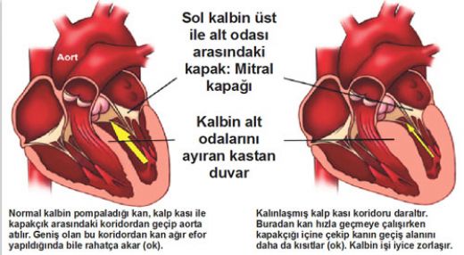 Kalp Kas Hastalklar