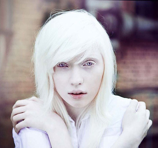 Albino Hastal